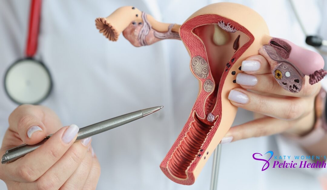 Urogynecology What is it? Some Quick Facts