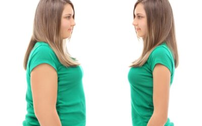 Can Fibroids Cause Weight Gain?