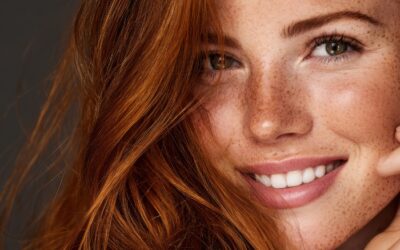 How to Get Rid of Freckles: Safe and Effective Methods for Clearer Skin