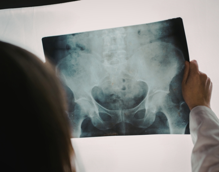 Pelvic Organ Prolapse Treatment Katy TX | Symptoms & Care