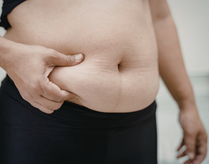 Sudden Weight Gain in Women Woman concerned about sudden weight gain and hormonal changes